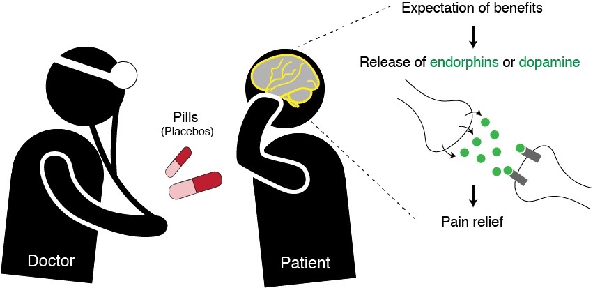 What is the placebo effect: real use cases