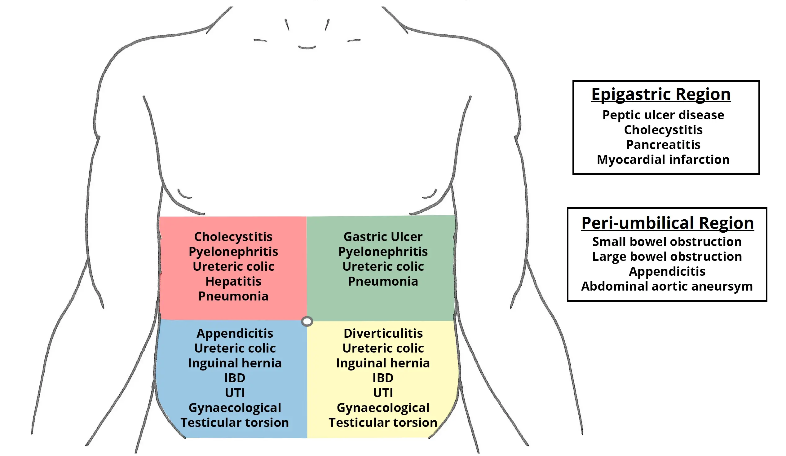 Acute abdomen in adults