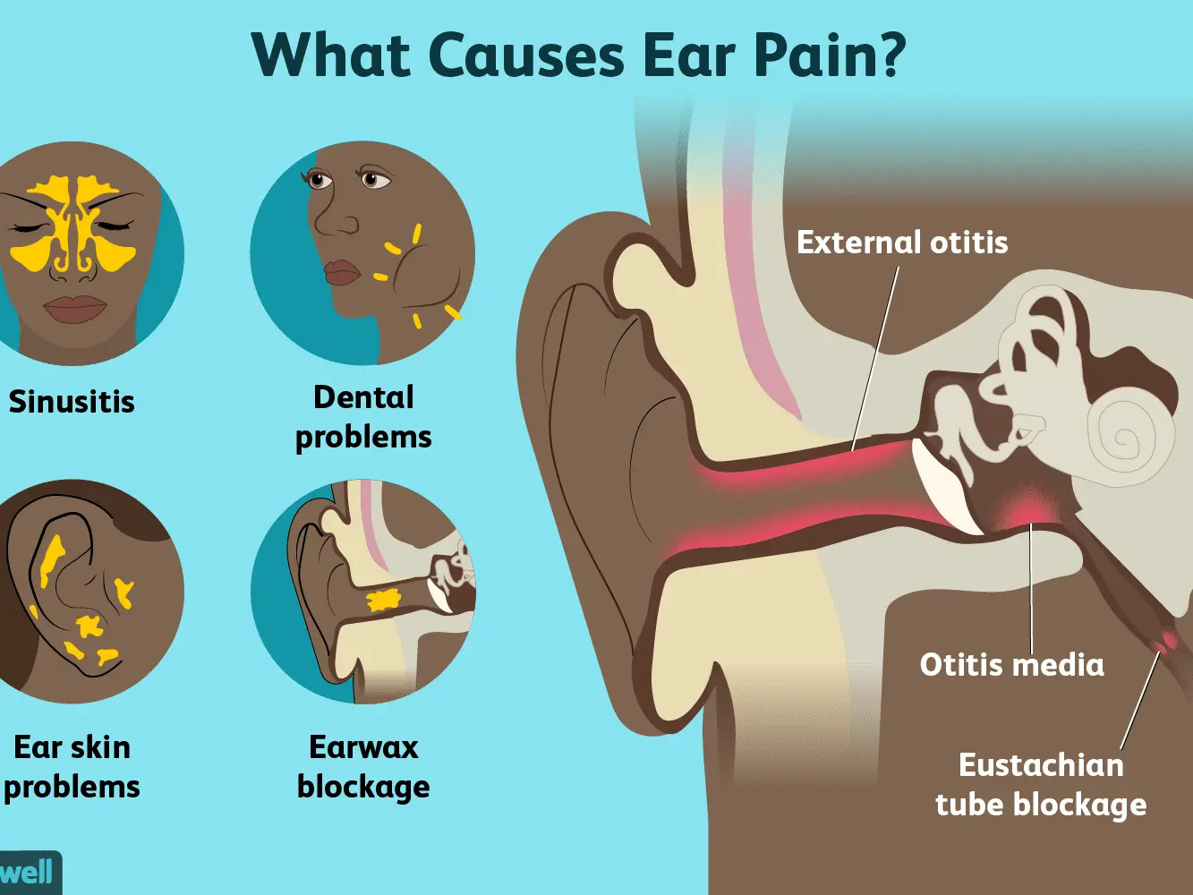 Adult ear pain