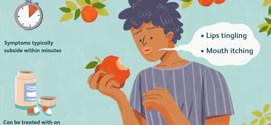 Allergy to apples in adults