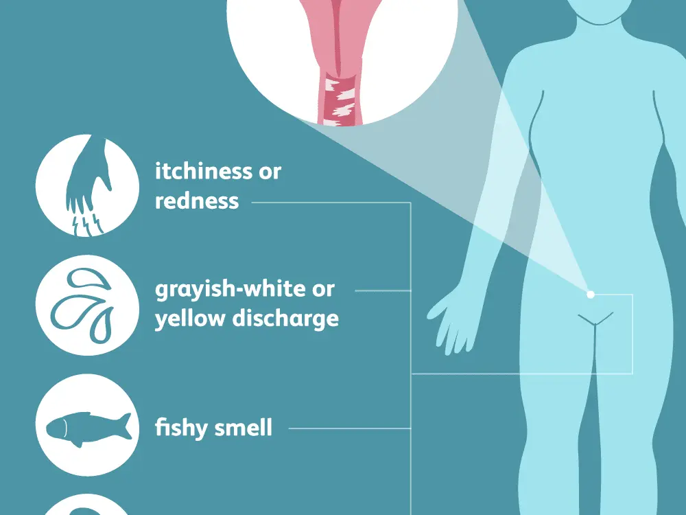 Bacterial vaginosis in adults