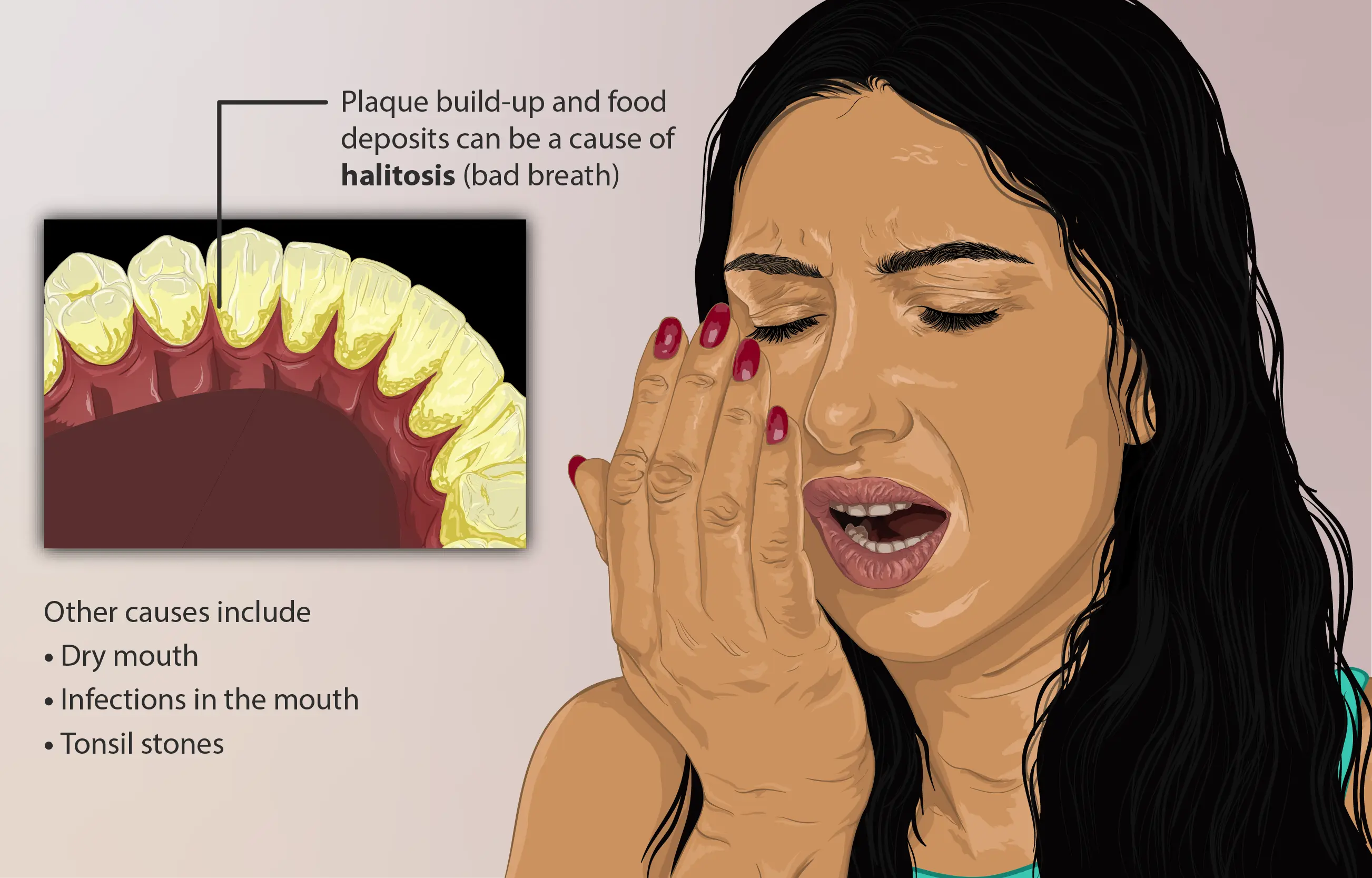 Bad breath in adults