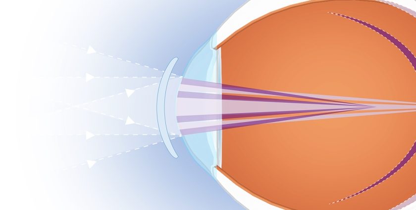 Bedste øjenlinser til nærsynethed 2022