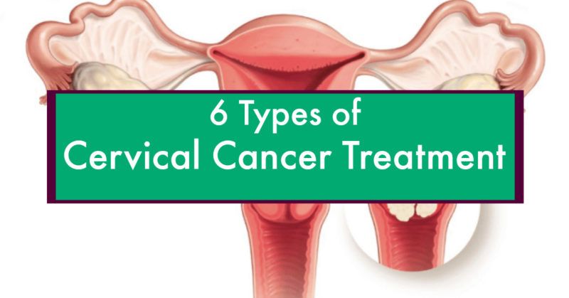 Best Treatments for Cervical Cancer