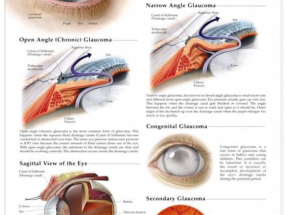 Best Treatments for Glaucoma