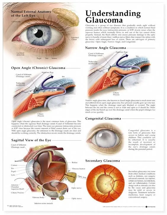 Best Treatments for Glaucoma