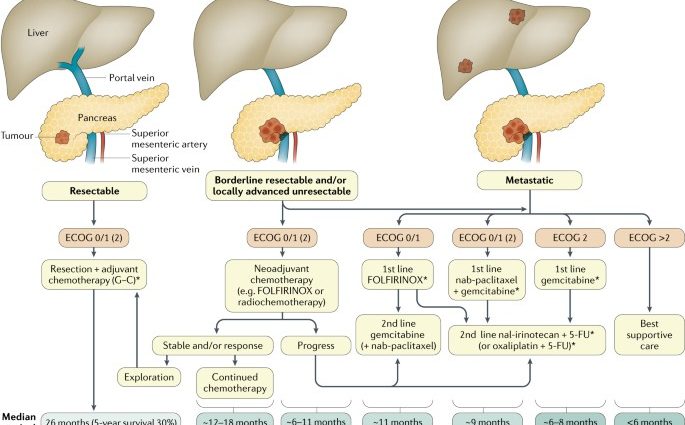 Best Treatments for Pancreatic Cancer