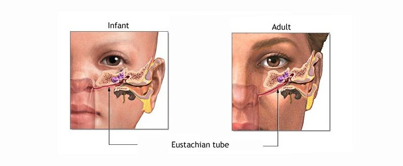 Blocked ear in an adult