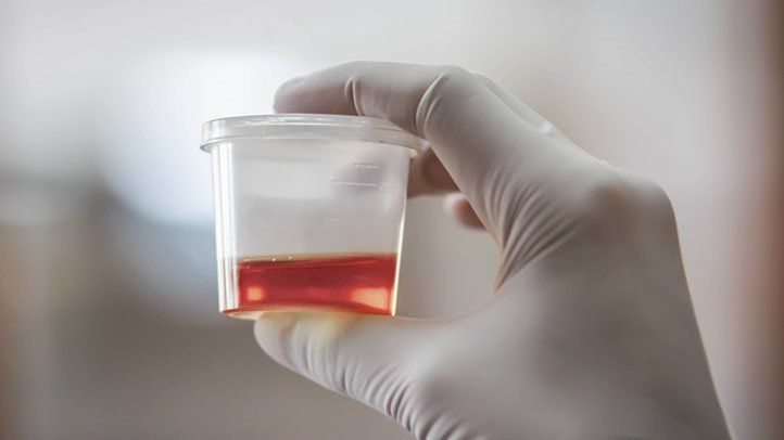 Blood in woman&#8217;s urine