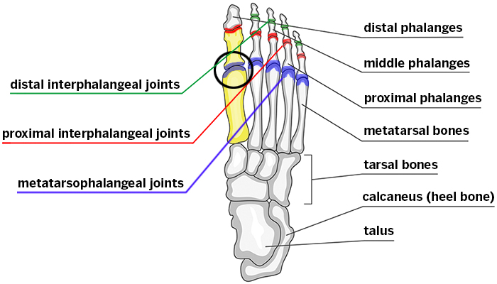 Bone on big toe