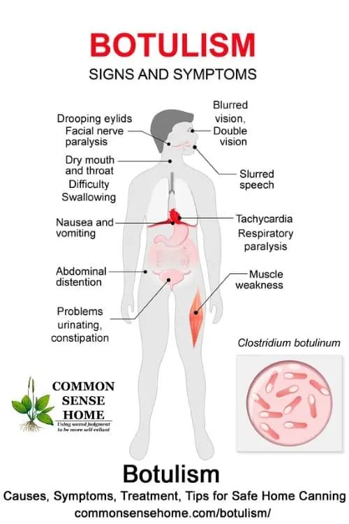 Botulism in adults