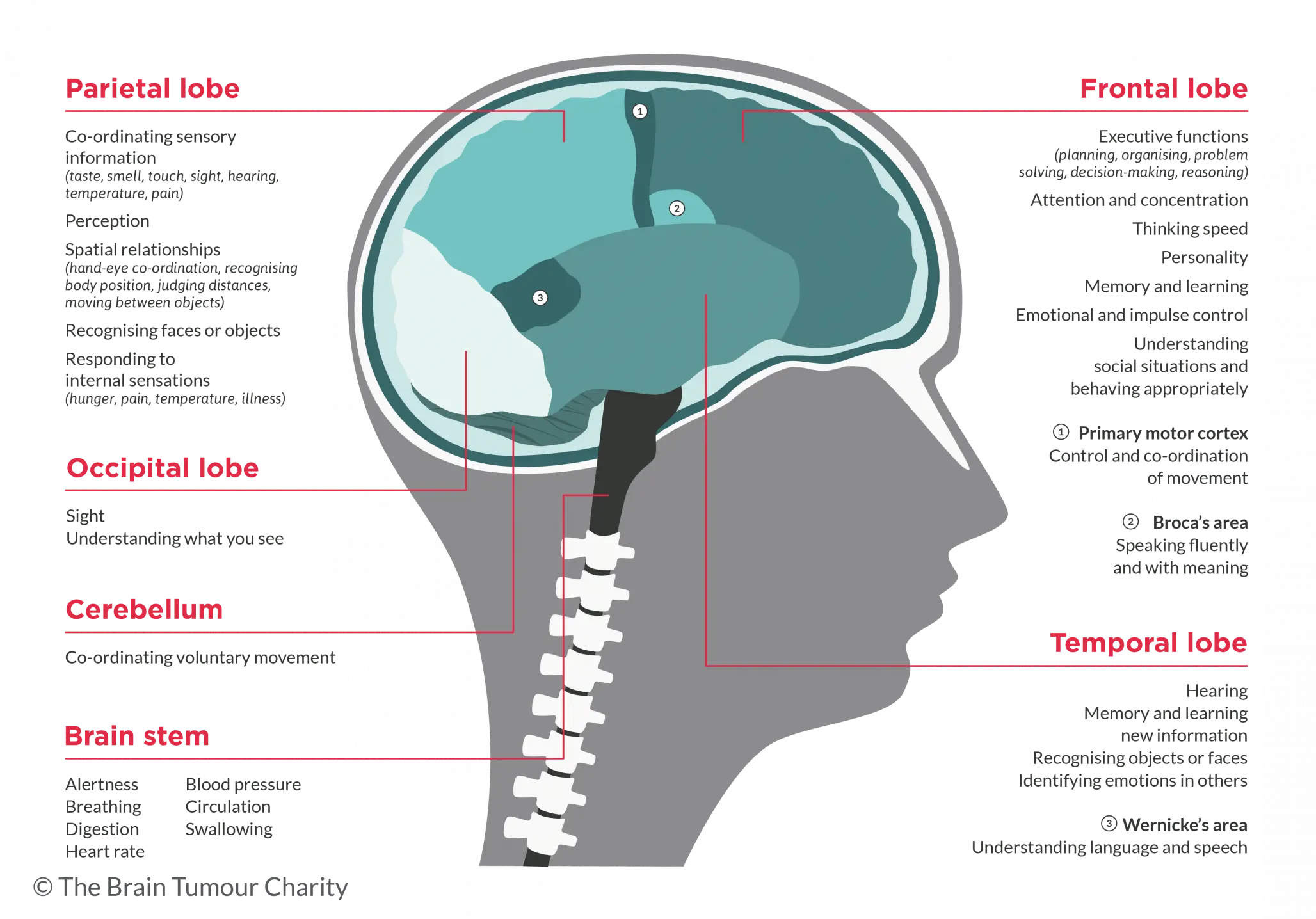 brain tumor in adults