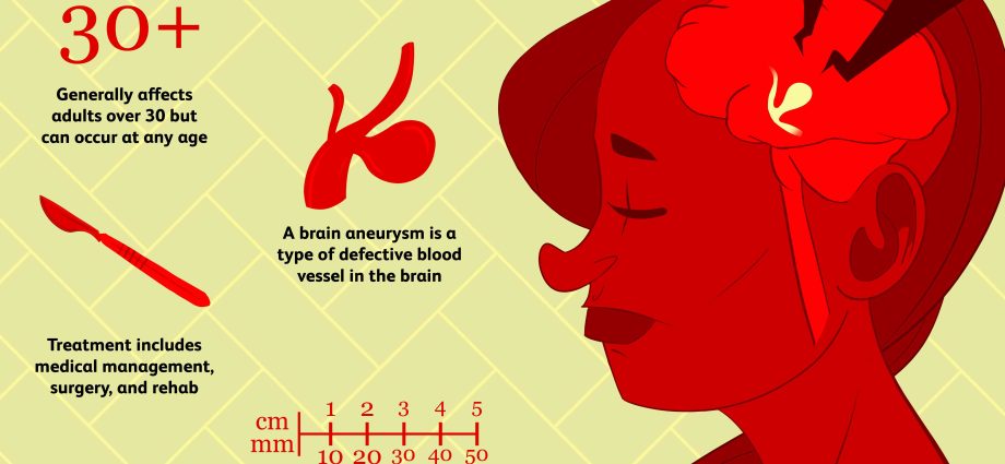 Cerebral aneurysm in adults