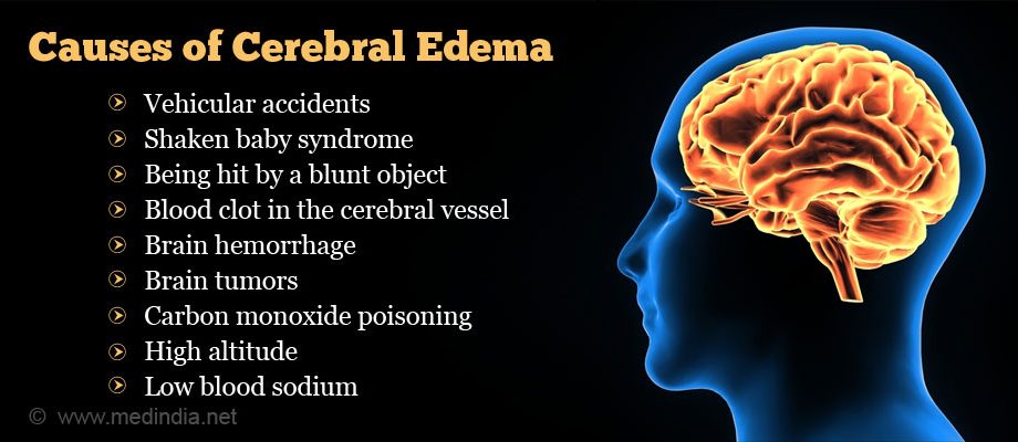 Cerebral edema in adults