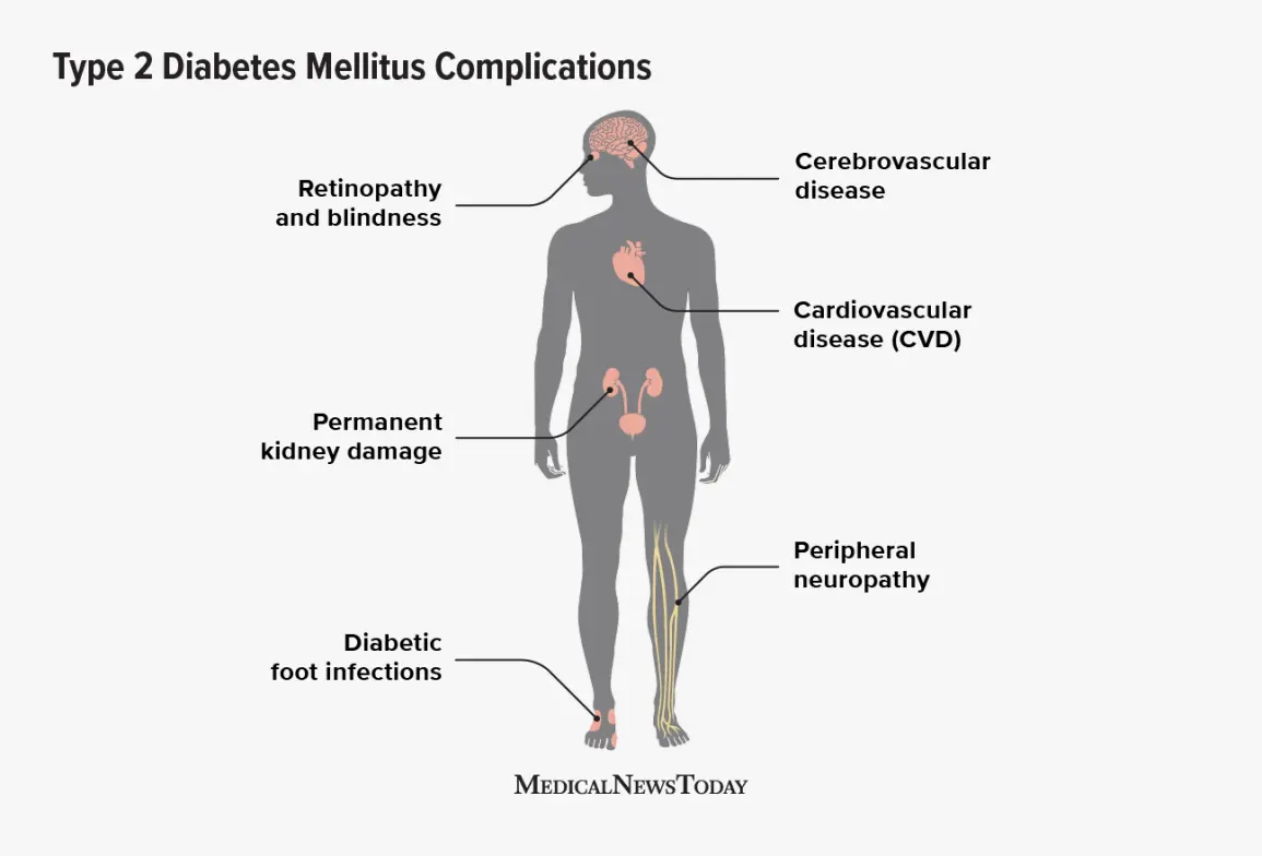 Complications in type 2 diabetes