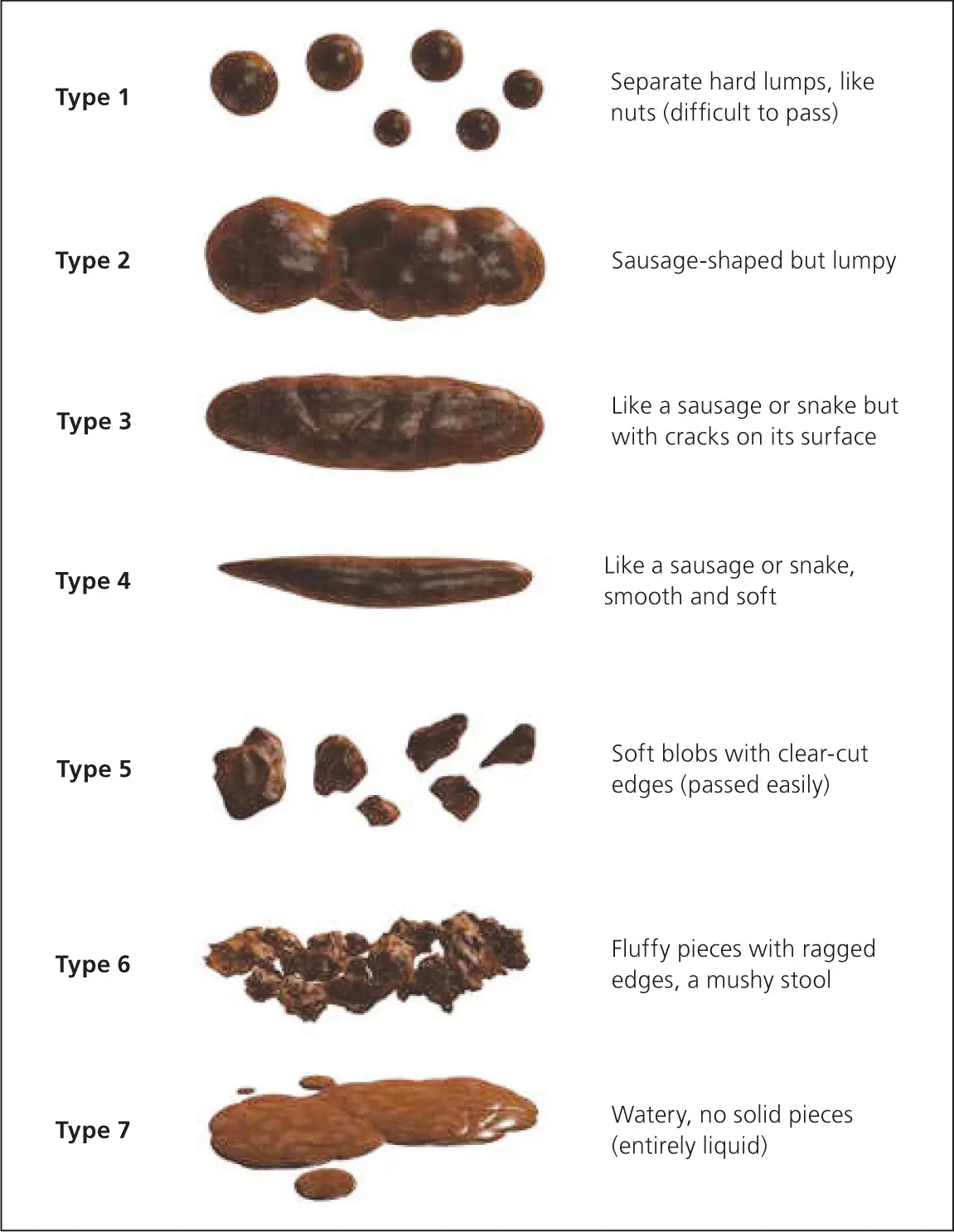 Constipation in adults