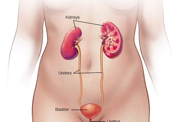 cystitis in women