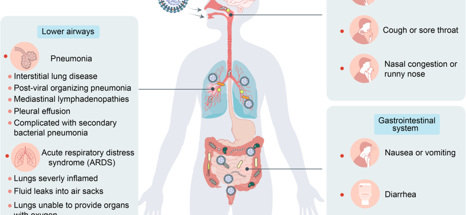 Diarrhea in coronavirus in humans