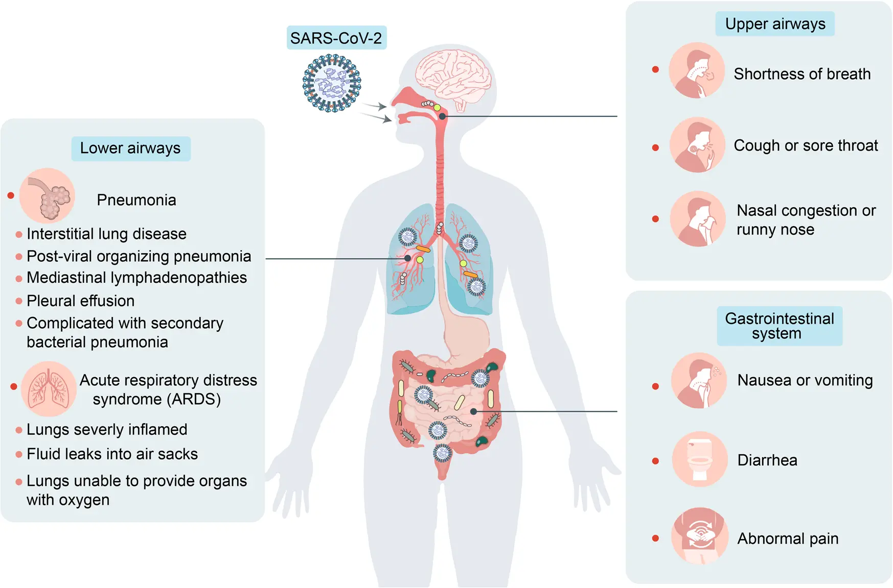 Diarrhea in coronavirus in humans