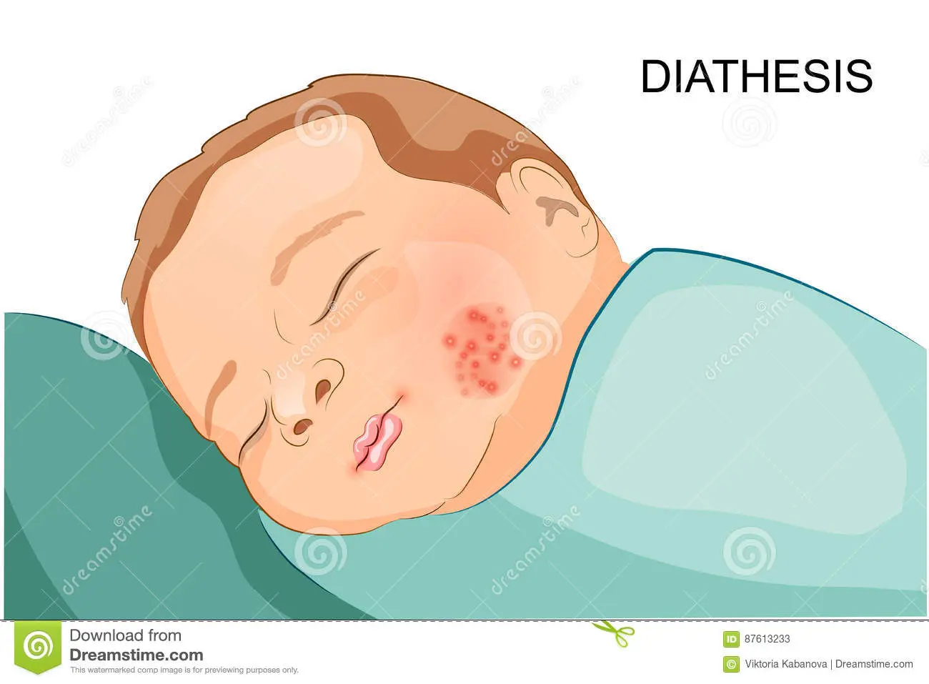 Diathesis in children