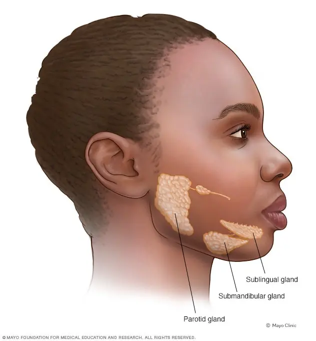 Dry mouth in adults