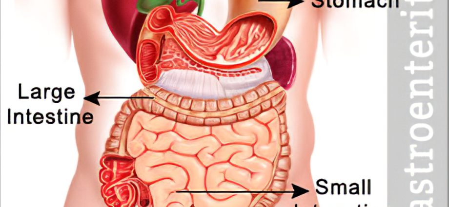 Enteritis латынь