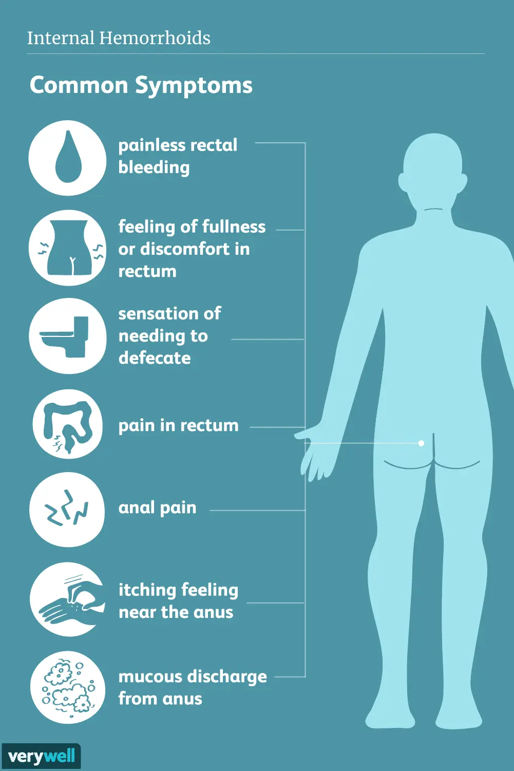 External hemorrhoids in men