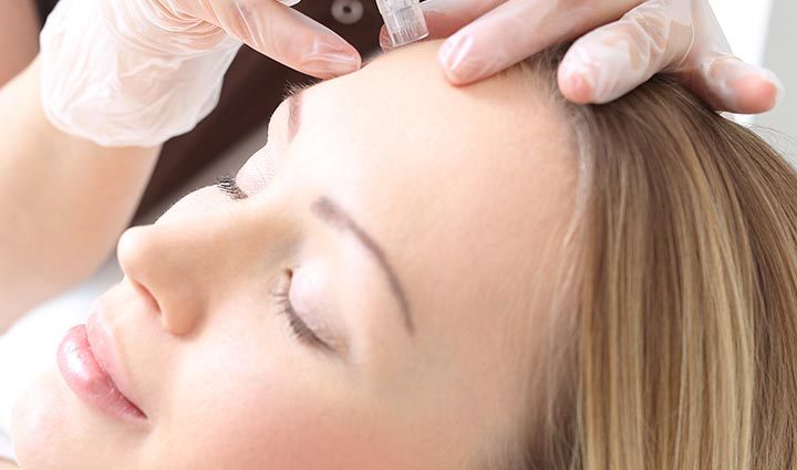 Mesotherapy aghaidh