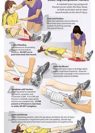 First aid for fractures