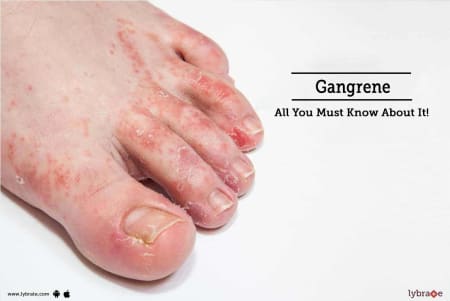 gangrene in adults