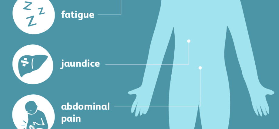 Gilbert&#8217;s syndrome in adults