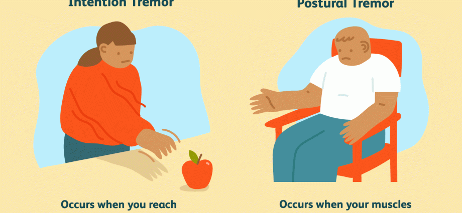 Head tremor in adults