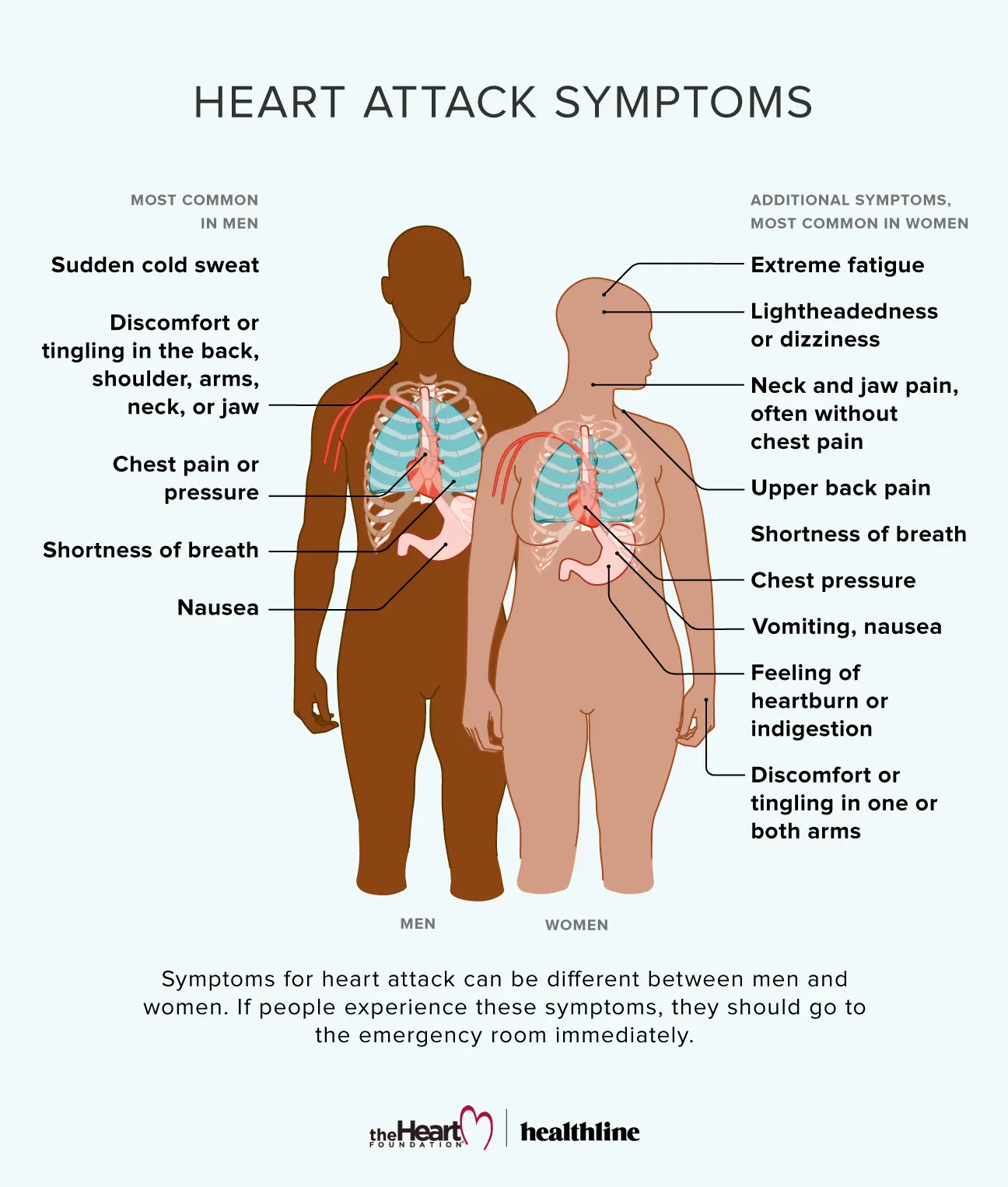 Heart attack in women