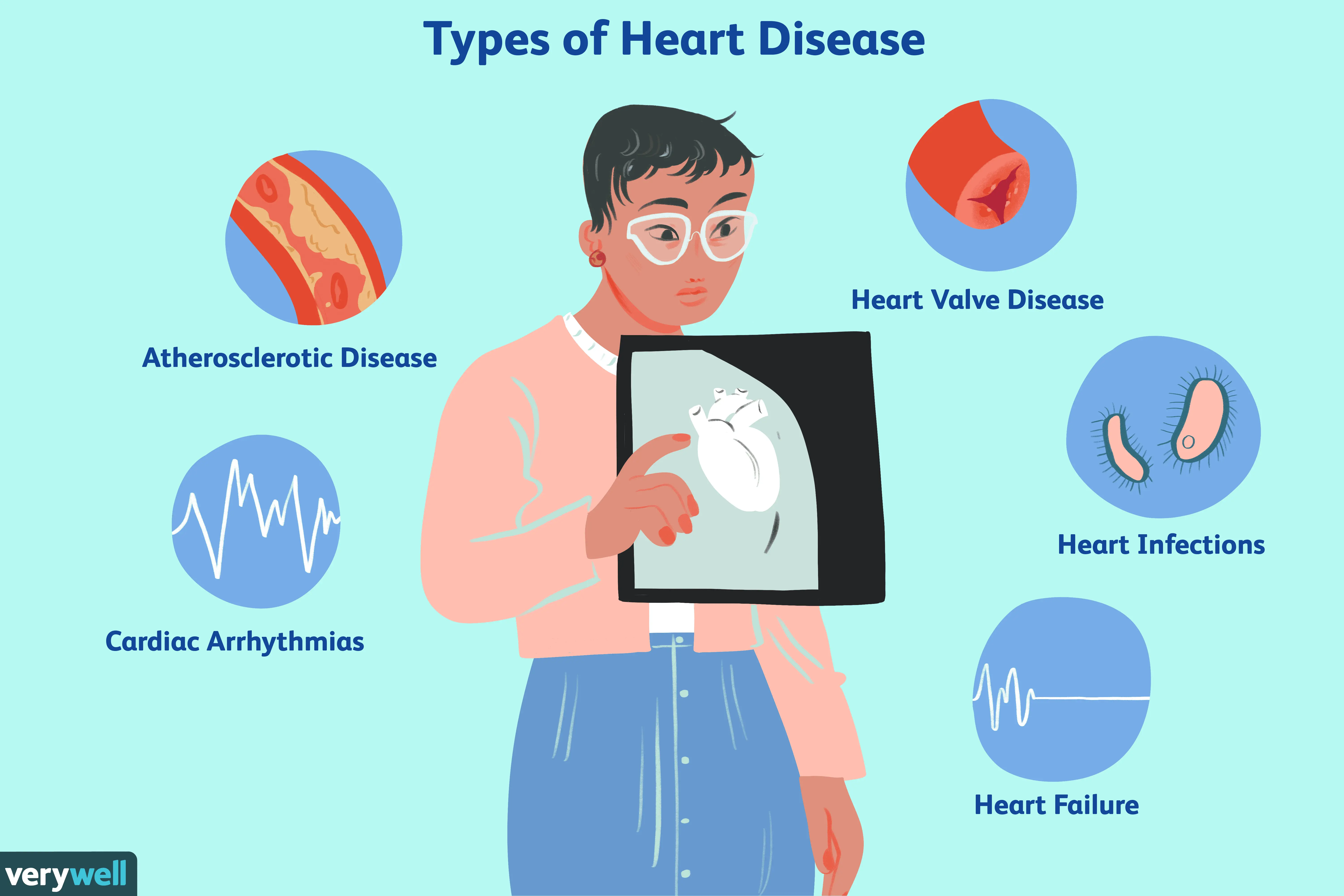 Heart diseases