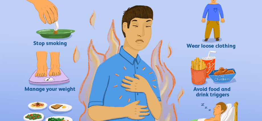 Heartburn after eating