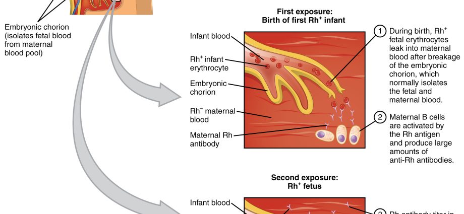 Hemolytic disease of the newborn