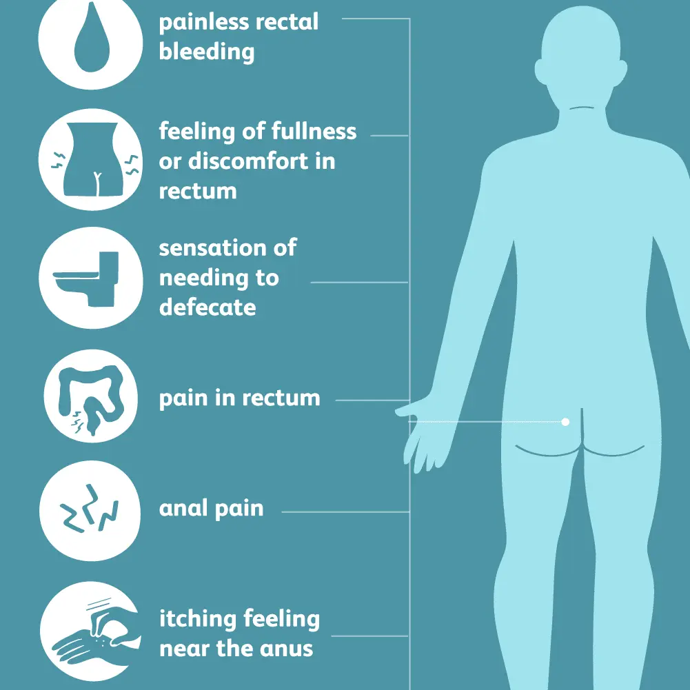 Hemorrhoids in men