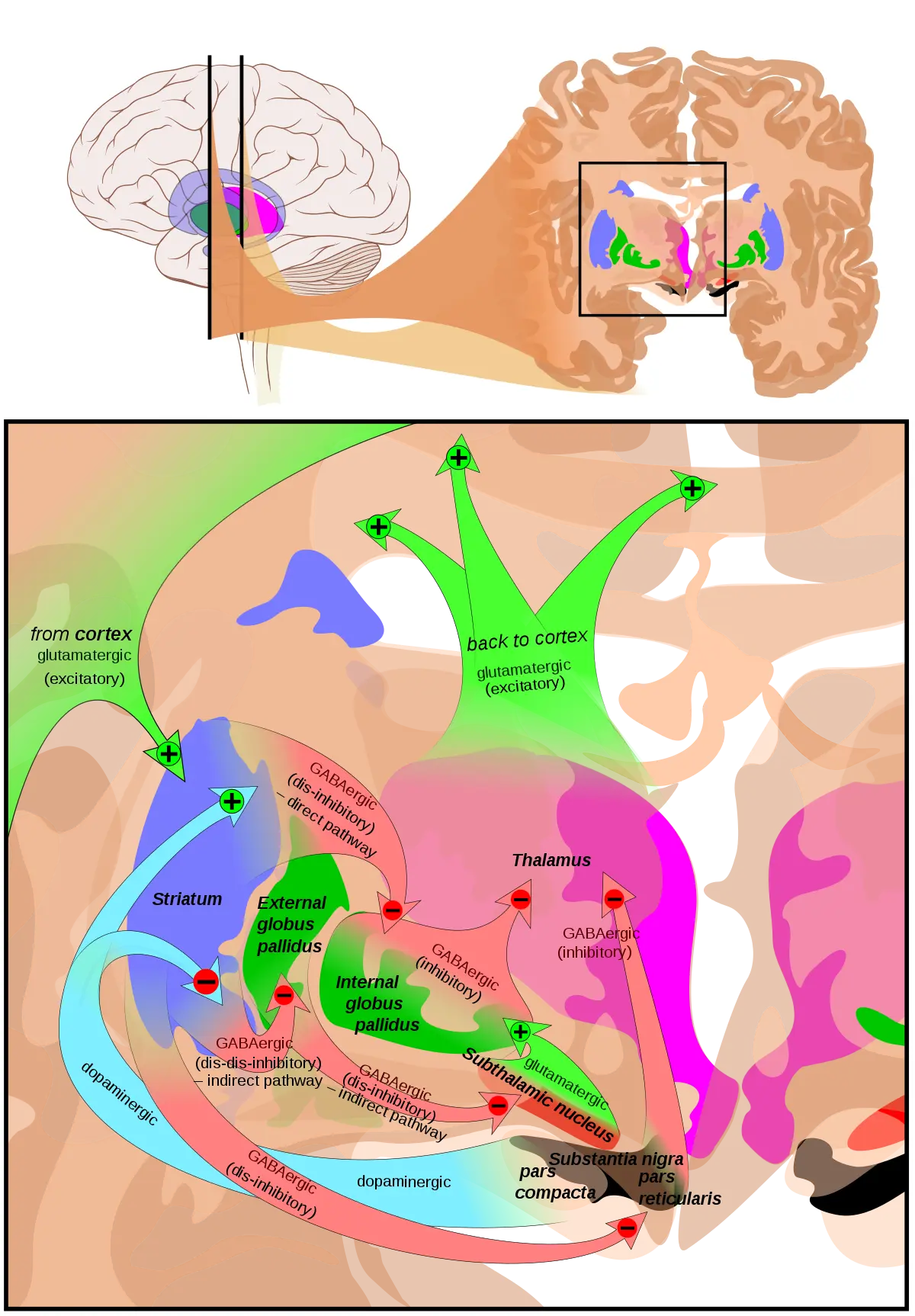 Hyperkinesis in adults