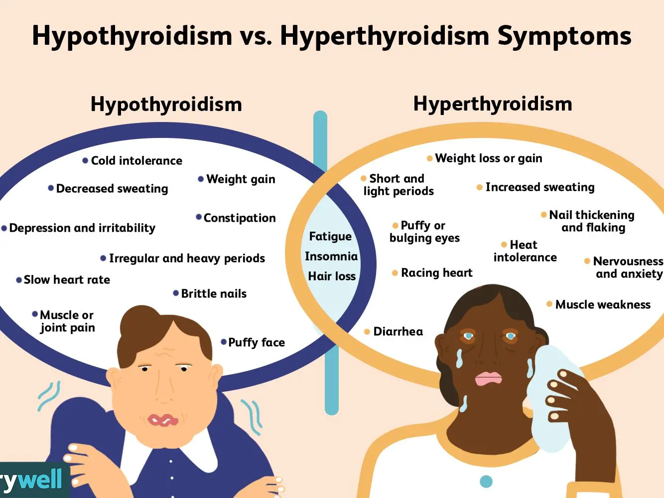 Hypothyroidism in adults