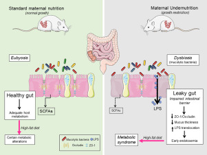 Intestinal dysbacteriosis in adults