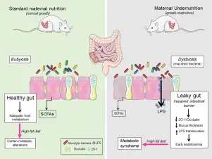 Intestinal dysbacteriosis in adults