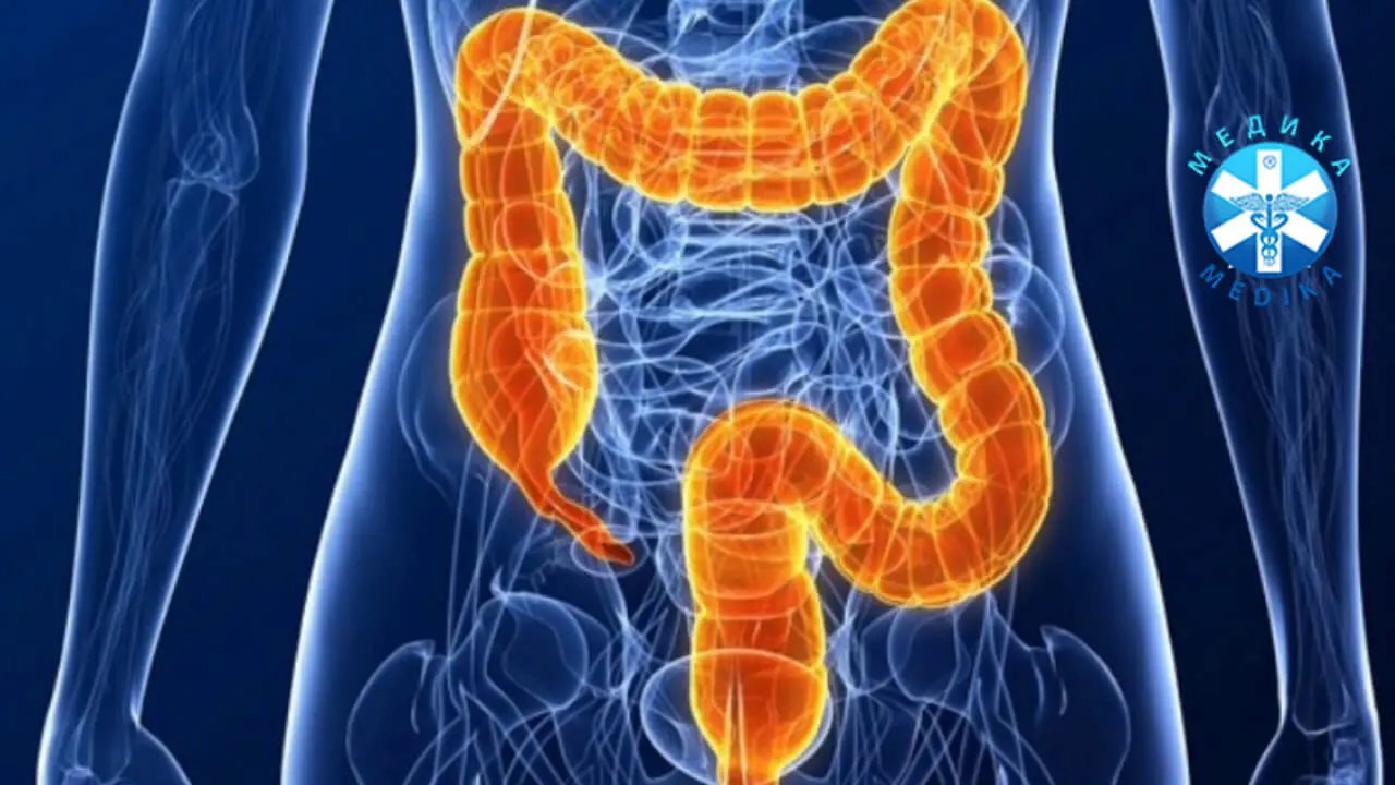 Irrigoscopy of the intestine
