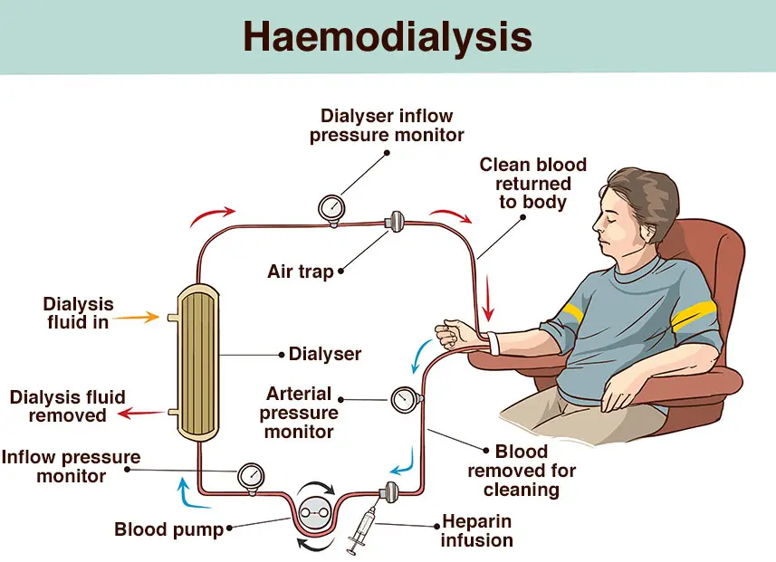 Kidney failure in adults