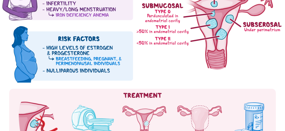 Leiomyoma of the uterus