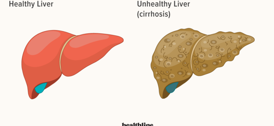 Liver Disease