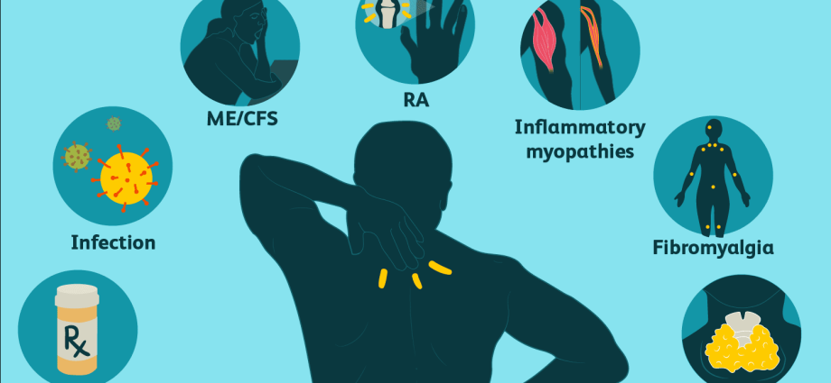 Muscle strain in adults