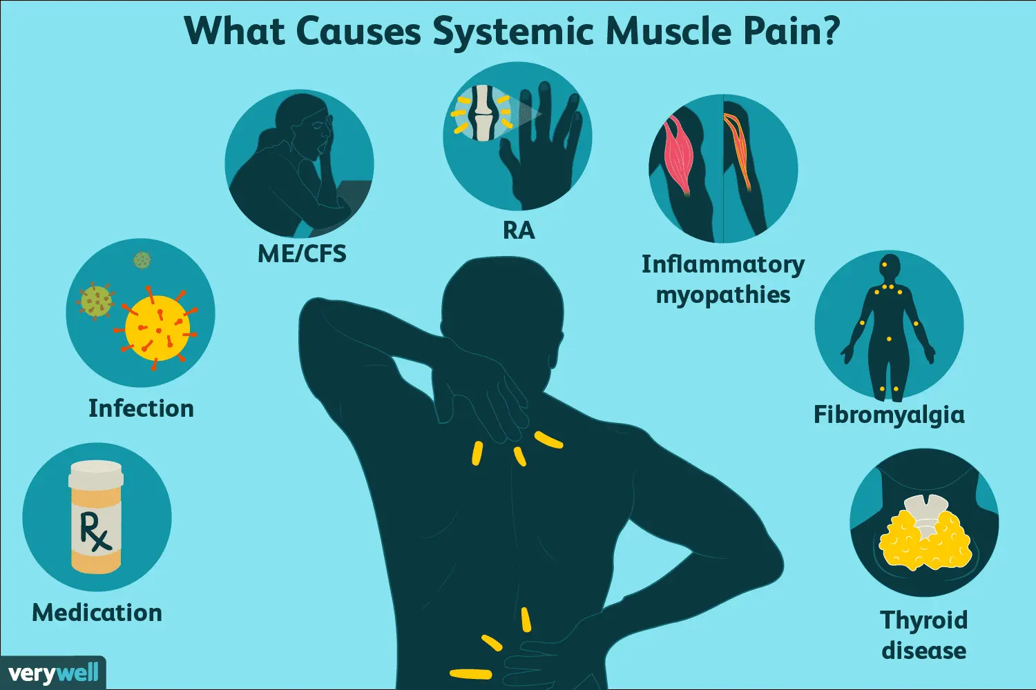 Muscle strain in adults