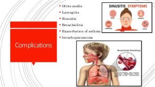 Nasopharyngitis in children