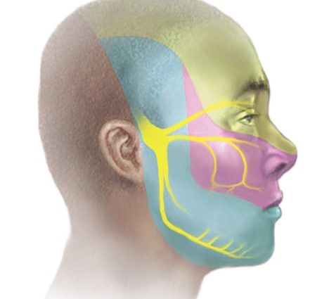 Neuritis of the facial nerve in adults