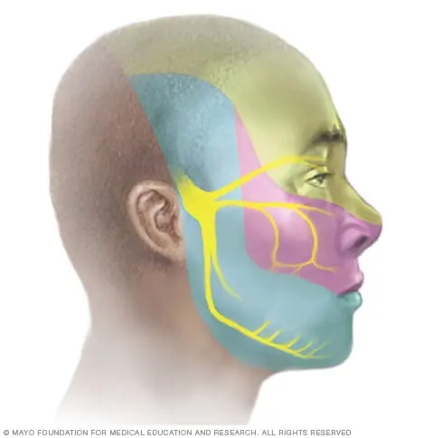 Neuritis of the facial nerve in adults